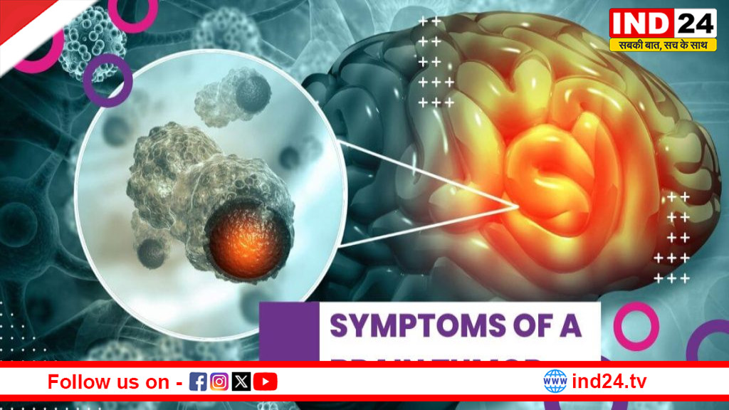 सिरदर्द से शुरू होकर जानलेवा तक: ये संकेत हो सकते हैं ब्रेन ट्यूमर की चेतावनी