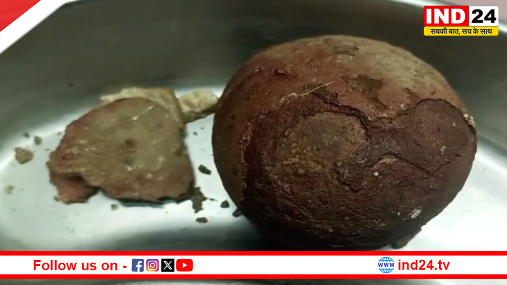 पन्ना में चिकित्सा चमत्कार: 18 साल की पीड़ा का अंत, युवक के पेट से निकाली गई आधा किलो वजनी पथरी