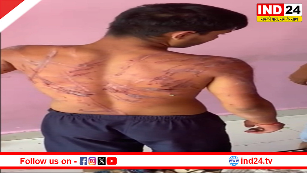 रायपुर: नशा मुक्ति केंद्र में मारपीट का आरोप, संचालिका के बेटे पर FIR