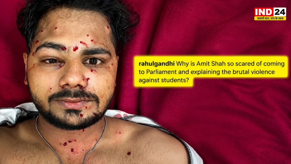 अमित शाह संसद आने से क्यों डर रहे हैं?': घायल छात्र की फोटो शेयर कर राहुल गांधी ने गृह मंत्री पर दागे सवाल