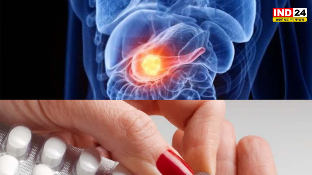 Pancreatic Cancer: अमेरिका में नई दवा ‘RasOnc’ को FDA की मंजूरी, एडवांस्ड मरीजों के लिए बड़ी उम्मीद