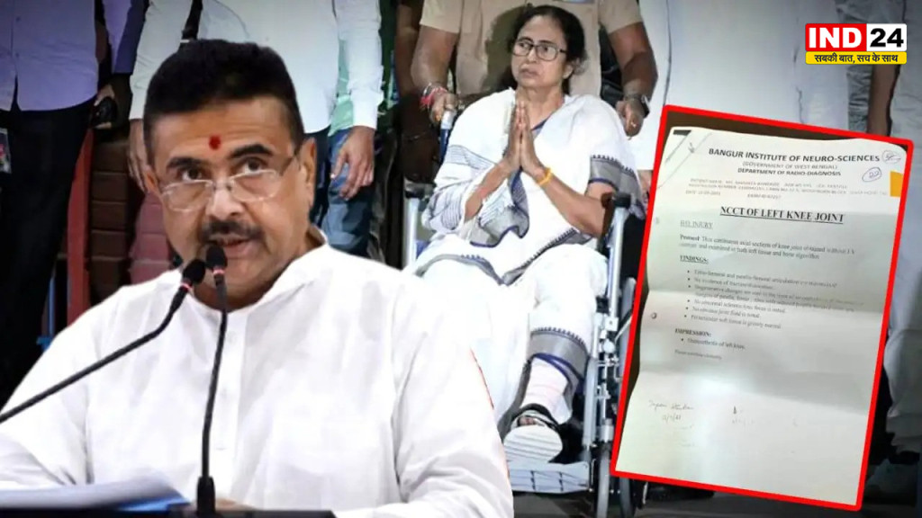 नंदीग्राम में ममता बनर्जी की चोट पर फिर विवाद, सुवेंदु अधिकारी ने उठाए सवाल; सामने आईं बांगर की रिपोर्ट