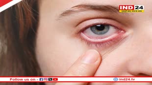आखिर क्या है Dry Eye Syndrome? जानिए सर्दियों में कैसे करें इससे बचाव 
