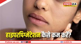 गर्मियों में हाइपरपिग्मेंटेशन की समस्या से कैसे बचे? 