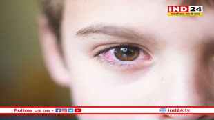 Eye Flu: बड़े ही नहीं बच्चों को भी अपनी चपेट में ले रहा है कंजंक्टिवाइटिस, ऐसे रखें उनका ध्यान