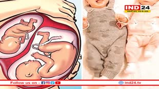 क्या होता है सुपरफेटेशन, जिसमें एक साथ दो अलग प्रेग्नेंसी हो जाती हैं ?