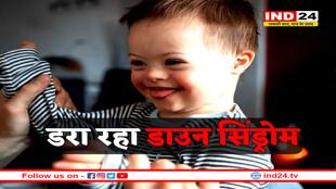 डाउन सिंड्रोम को लेकर WHO की डराने वाली रिपोर्ट, हर साल पैदा हो रहे 37 हजार बच्चे