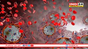 2030 तक HIV संक्रमण से 30 लाख लोगों की होगी मौत- वैज्ञानिको की चेतावनी