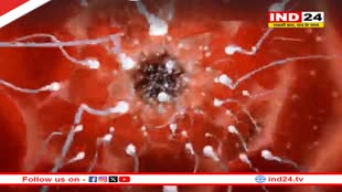 क्या होता है सुपरफेटेशन, जिसमें एक साथ दो अलग प्रेग्नेंसी हो जाती हैं ?