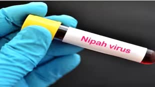 निपाह वायरस के खतरे से रहें सावधान, केरल में एक बच्चे की हो चुकी है मौत