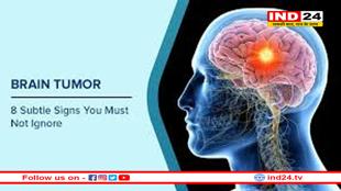 विश्व ब्रेन ट्यूमर दिवस 2025- समय पर पहचान और आधुनिक तकनीक से संभव है जीवन रक्षा