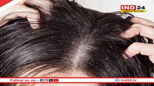 सर्दियों में ड्राई स्कैल्प से हैं परेशान, तो राहत पाने के लिए अपनाएं ये आसान उपाय