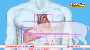 सुअर की किडनी लगाकर 130 दिन तक जिंदा रही अमेरिकन महिला