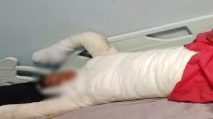 CG NEWS:  एकतरफा प्यार में पागल प्रेमी ने प्रेमिका को लगाई आग....इलाज के दौरान मौत, Police ने आरोपी को किया गिरफ्तार 