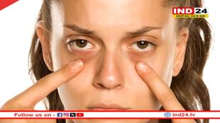 3 घरेलू उपाय जो दूर करें आंखों के नीचे काले घेरे