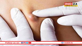 पेट में आई हल्की सी गांठ को न करें अनदेखा! तुरंत कराए टेस्ट