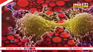 एम्स भोपाल में एआई से होगी कैंसर स्क्रीनिंग, मिलेगा जल्दी और सटीक इलाज