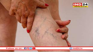 शरीर की कोई भी नस बंद हो खुल जाएगी! इन उपायों से सर्जरी की नौबत नहीं आएगी 