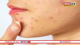 तेज गर्मी स्किन को कर सकती है खराब