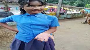 CG NEWS : गर्म तेल से 25 बच्चों के हाथ जले… स्कूल के शिक्षकों पर लगा जलाने का आरोप, 3 टीचर होंगे निलंबित.....