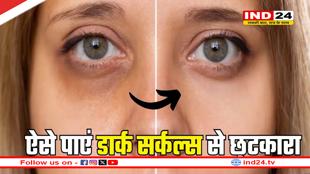 डार्क सर्कल्स को कम करने में मददगार ऑयल्स, ऐसे पाएं छुटकारा 