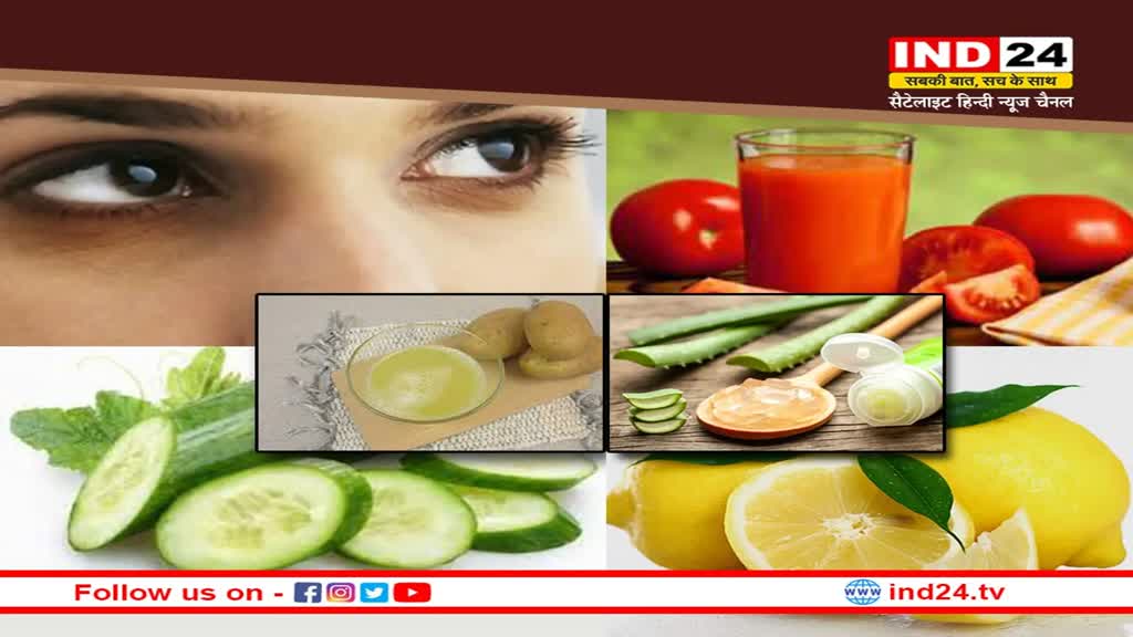 Dark Circles Natural Remedies : आंखों के नीचे काले घेरों और सूजन से दिलाएंगे ये 10 नैचुरल उपाय आराम