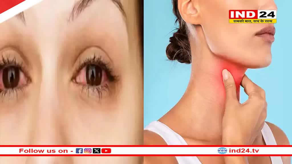 बारिश के मौसम में आई फ्लू और थ्रोट इन्फेक्शन से रहे सावधान