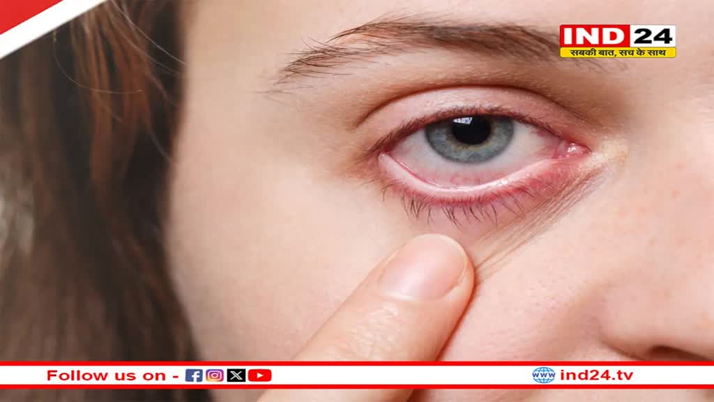 आखिर क्या है Dry Eye Syndrome? जानिए सर्दियों में कैसे करें इससे बचाव 
