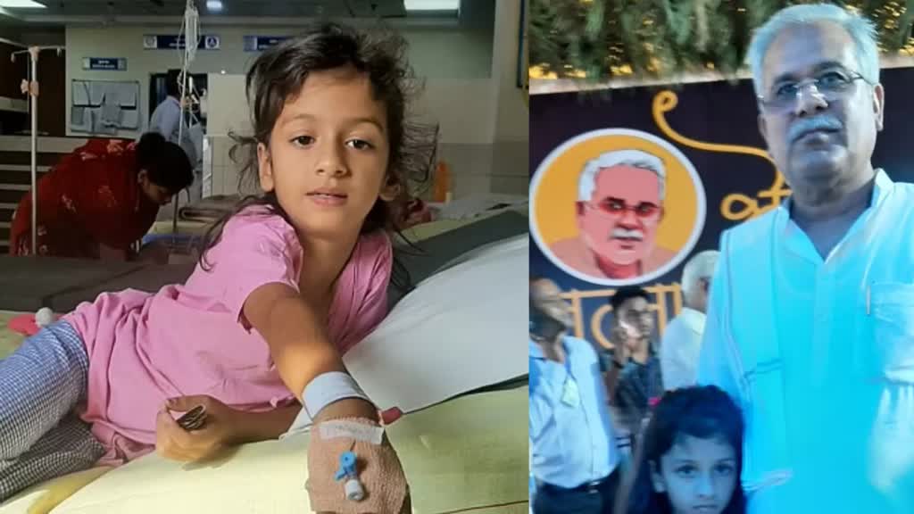 CG News : मुख्यमंत्री ने पूरा किया नन्हीं वर्षा से किया अपना वायदा,वर्षा की सफल हुई सर्जरी, अब वह सुन सकेगी....