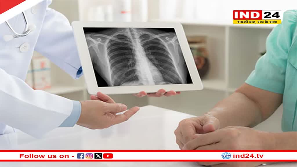 Health Tips: निमोनिया से बचाव में मदद कर सकते हैं ये फूड आइटम्स, जरूर करें इनका सेवन 