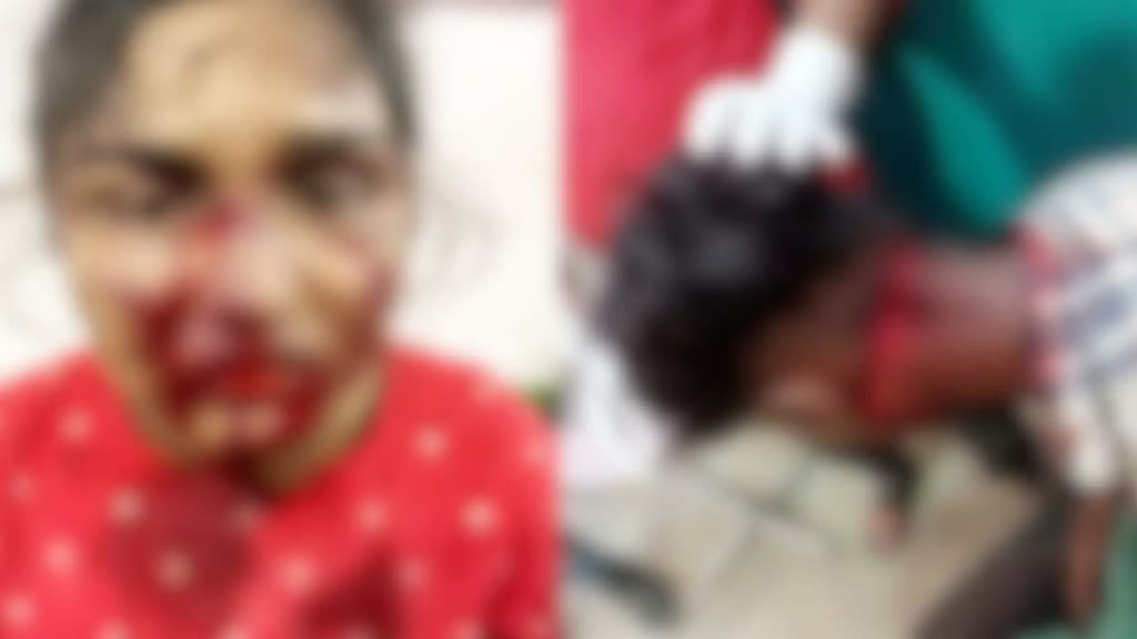 CG  NEWS : रक्षाबंधन के एक दिन पहले Chhattisgarh के इस जिले में भाई-बहन पर जानलेवा हमला। 