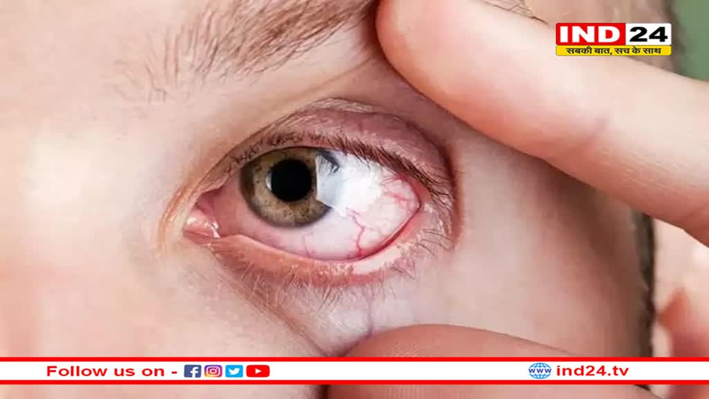 दिल का हाल बयां करती हैं आंखें, इन संकेतों को न करें अनदेखी