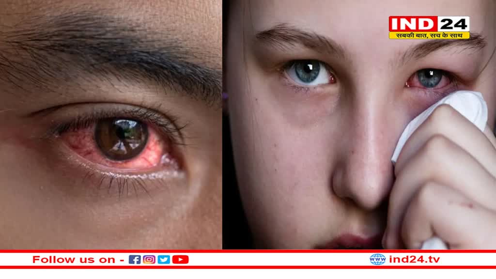 राजधानी दिल्ली समेत देश के तमाम हिस्सों में ‘आई फ्लू’ की चपेट में आ रहे हैं लोग, बच्चे हों या बूढ़े सबको लग रहा ये रोग !