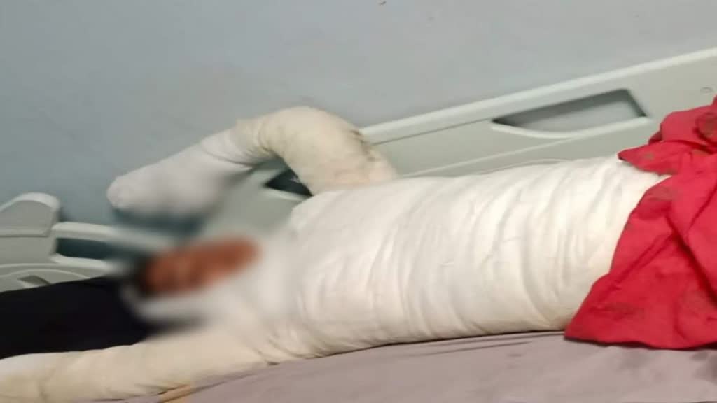 CG NEWS:  एकतरफा प्यार में पागल प्रेमी ने प्रेमिका को लगाई आग....इलाज के दौरान मौत, Police ने आरोपी को किया गिरफ्तार 