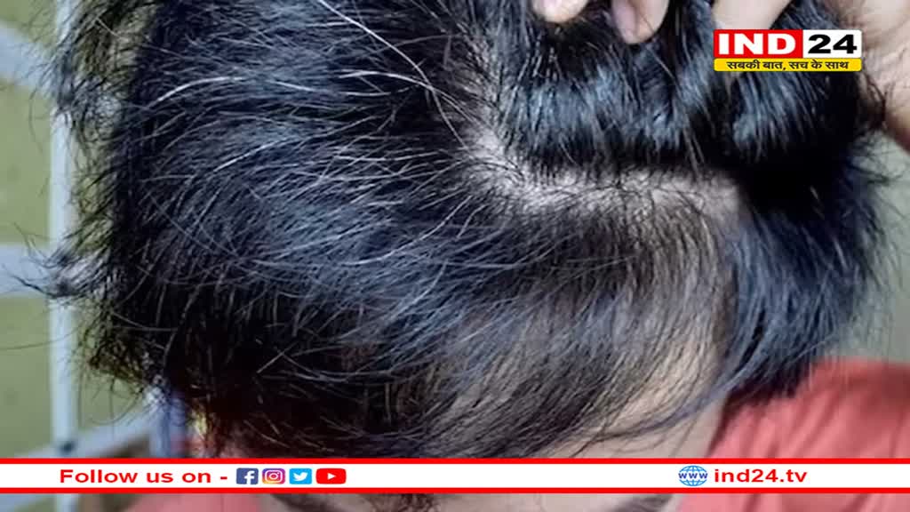 बच्चे के बाल अभी से होने लगे हैं सफेद, तो जान लें इसके पीछे की वजह