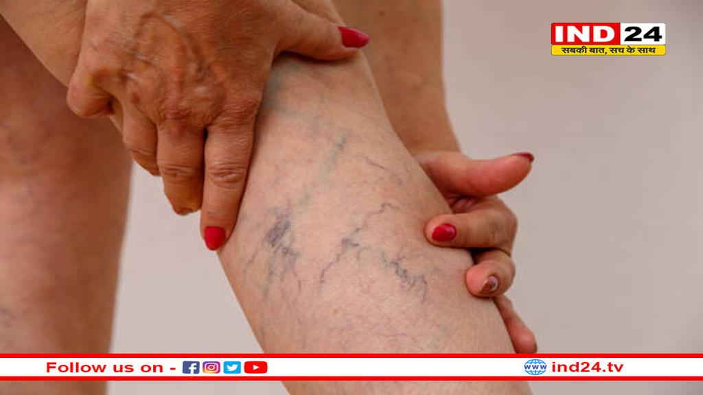 शरीर की कोई भी नस बंद हो खुल जाएगी! इन उपायों से सर्जरी की नौबत नहीं आएगी 
