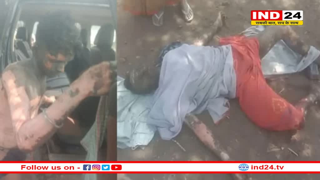 इंदौर: बम फैक्ट्री की आग में झुलसे दूसरे मजदूर ने भी दम तोड़ा, तीसरे की हालत भी नाजुक