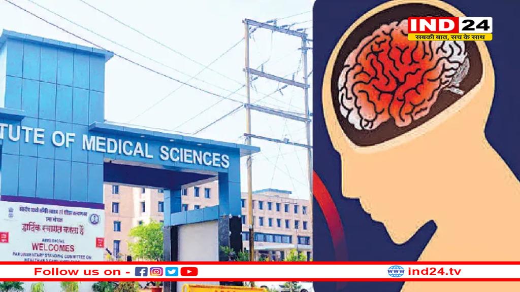 AIIMS की बड़ी उपलब्धि, 24 घंटे में होगा स्ट्रोक का एडवांस्ड इलाज