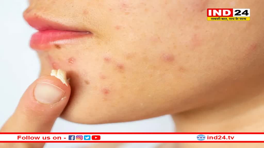 तेज गर्मी स्किन को कर सकती है खराब