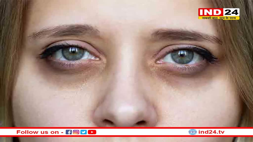 Health Tips: क्या आप भी डार्क सर्कल्स से हैं परेशान, तो इन सुपरफूड्स का करें सेवन 