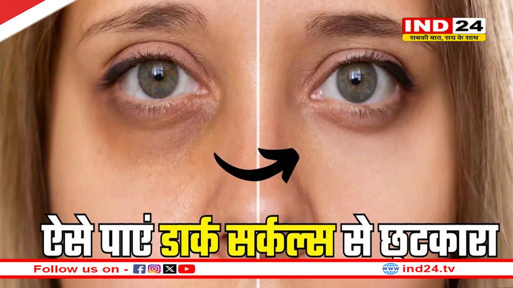 डार्क सर्कल्स को कम करने में मददगार ऑयल्स, ऐसे पाएं छुटकारा 